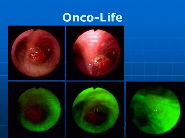 Onco-Life 