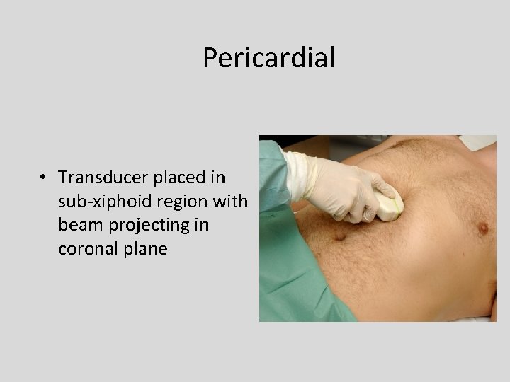 Pericardial • Transducer placed in sub-xiphoid region with beam projecting in coronal plane 