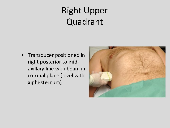 Right Upper Quadrant • Transducer positioned in right posterior to midaxillary line with beam