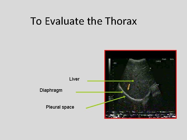 To Evaluate the Thorax Liver Diaphragm Pleural space 