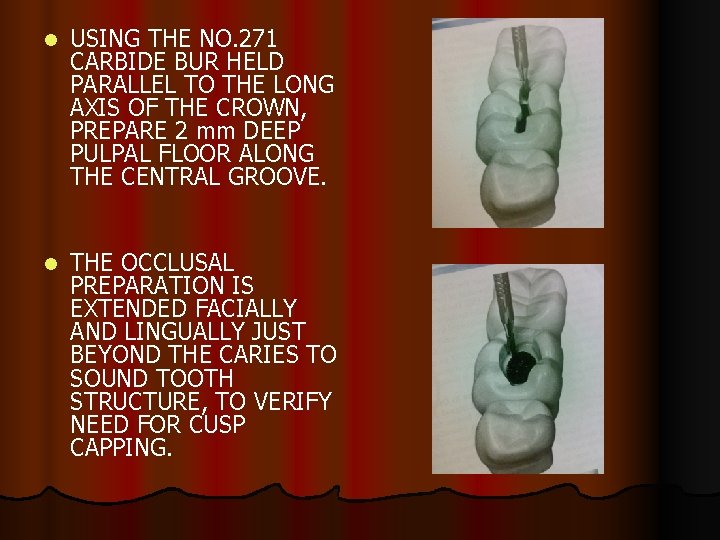 l USING THE NO. 271 CARBIDE BUR HELD PARALLEL TO THE LONG AXIS OF