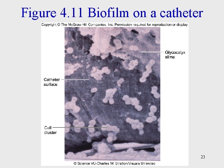 Figure 4. 11 Biofilm on a catheter 23 