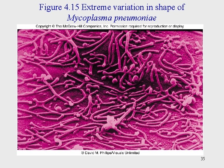 Figure 4. 15 Extreme variation in shape of Mycoplasma pneumoniae 35 