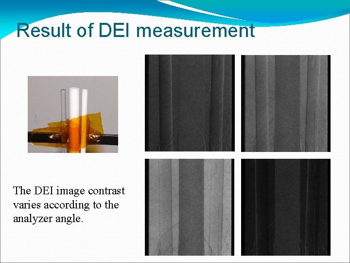 Result of DEI measurement The DEI image contrast varies according to the analyzer angle.