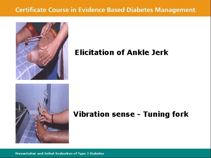 Elicitation of Ankle Jerk Vibration sense - Tuning fork Presentation and Initial Evaluation of