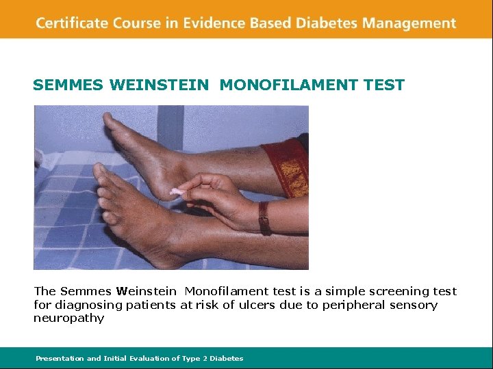 SEMMES WEINSTEIN MONOFILAMENT TEST The Semmes Weinstein Monofilament test is a simple screening test