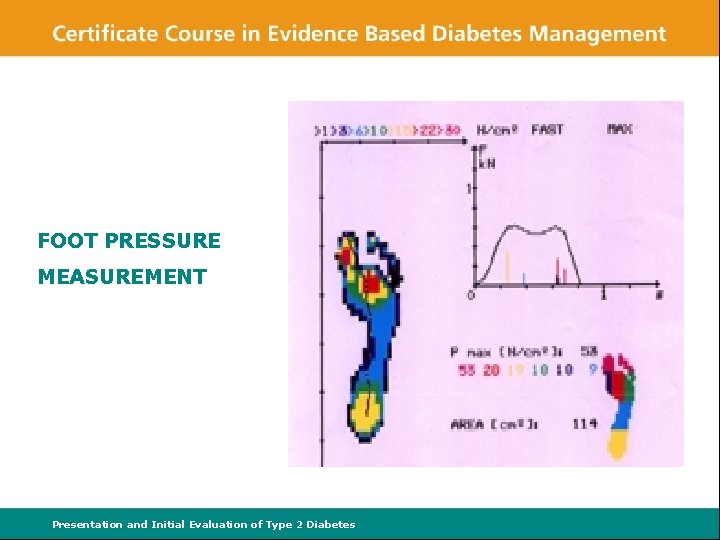 FOOT PRESSURE MEASUREMENT Presentation and Initial Evaluation of Type 2 Diabetes 