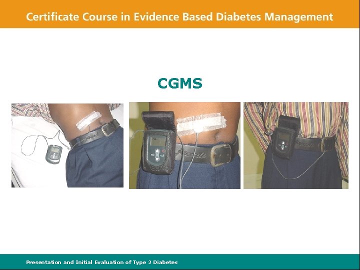CGMS Presentation and Initial Evaluation of Type 2 Diabetes 