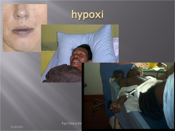 hypoxi 2/18/2021 Åge Wiberg Bøyum ALNSF-kongressen 2009 