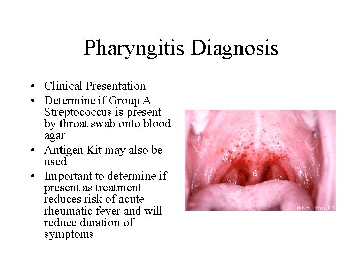 Pharyngitis Diagnosis • Clinical Presentation • Determine if Group A Streptococcus is present by