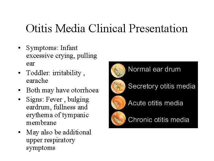 Otitis Media Clinical Presentation • Symptoms: Infant excessive crying, pulling ear • Toddler: irritability