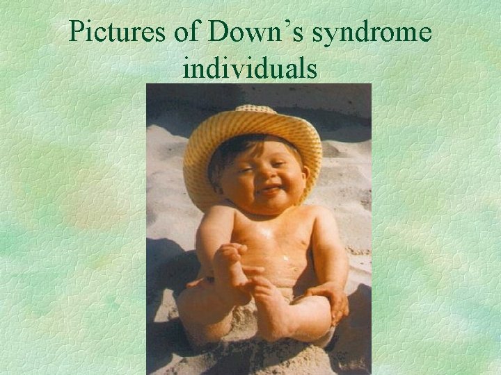 Pictures of Down’s syndrome individuals 