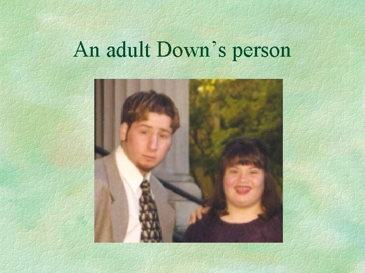 An adult Down’s person 