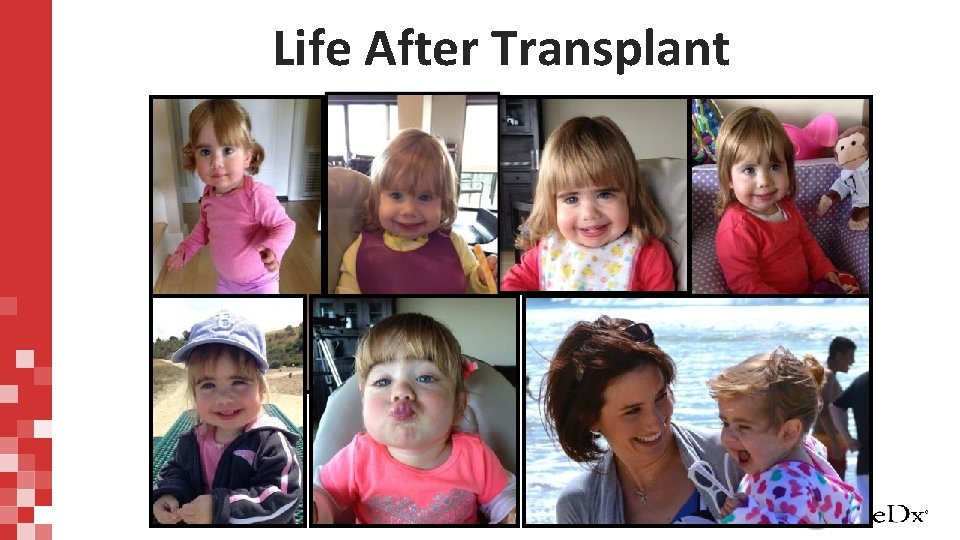 Life After Transplant 