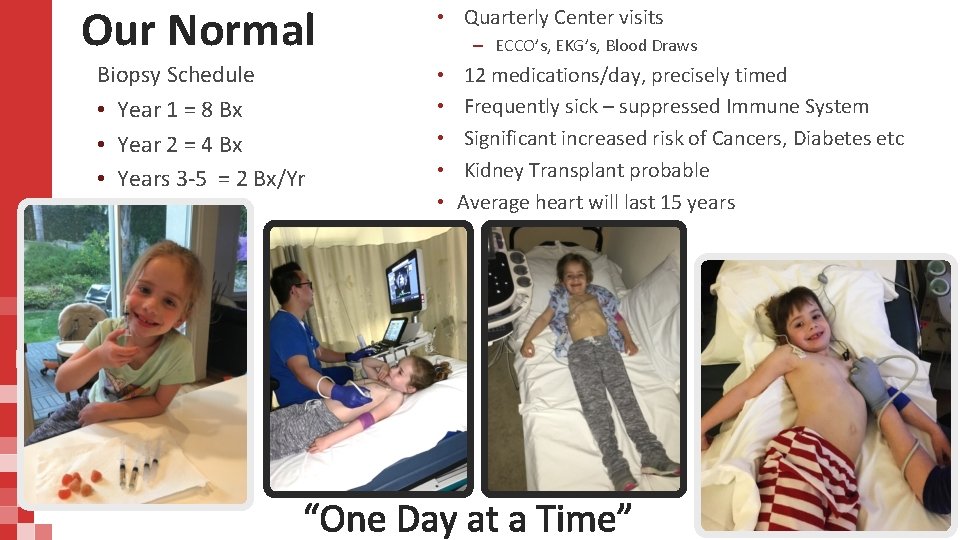 Our Normal Biopsy Schedule • Year 1 = 8 Bx • Year 2 =