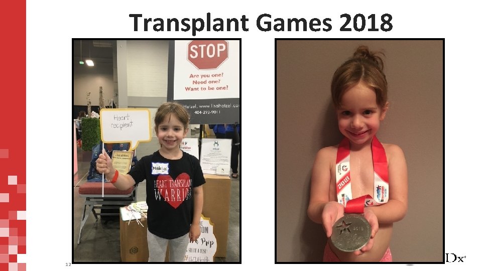 Transplant Games 2018 12 