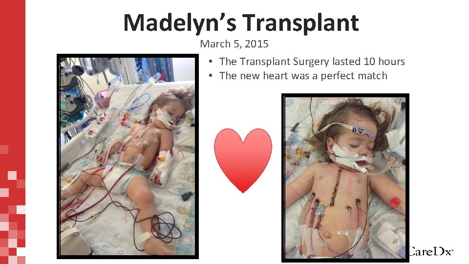 Madelyn’s Transplant March 5, 2015 • The Transplant Surgery lasted 10 hours • The