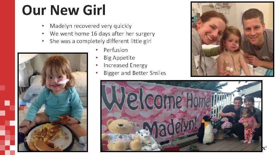 Our New Girl • Madelyn recovered very quickly • We went home 16 days