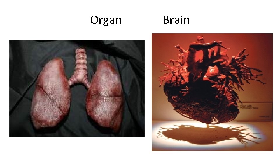 Organ Brain 