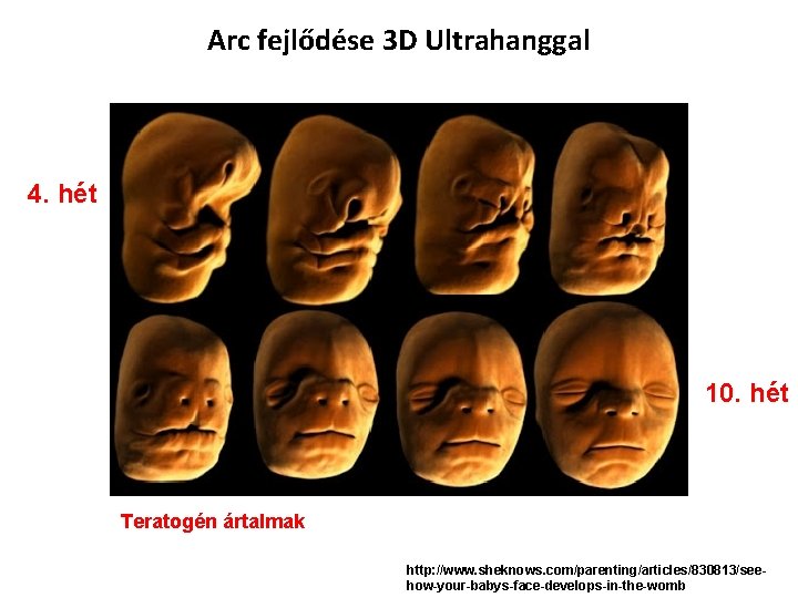 Arc fejlődése 3 D Ultrahanggal 4. hét 10. hét Teratogén ártalmak http: //www. sheknows.