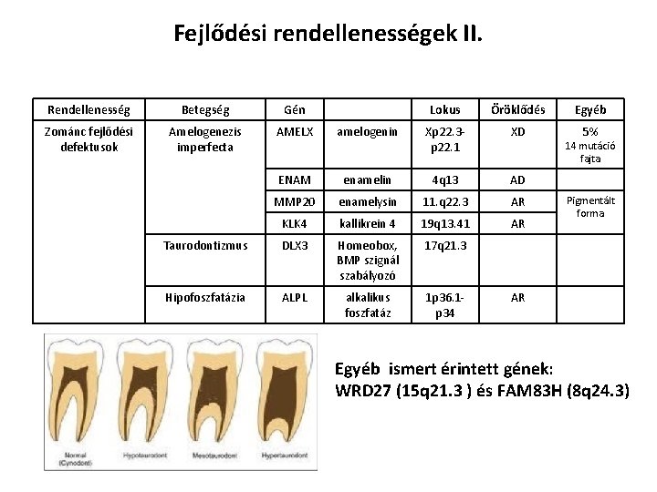 Fejlődési rendellenességek II. Rendellenesség Betegség Gén Lokus Öröklődés Zománc fejlődési defektusok Amelogenezis imperfecta AMELX