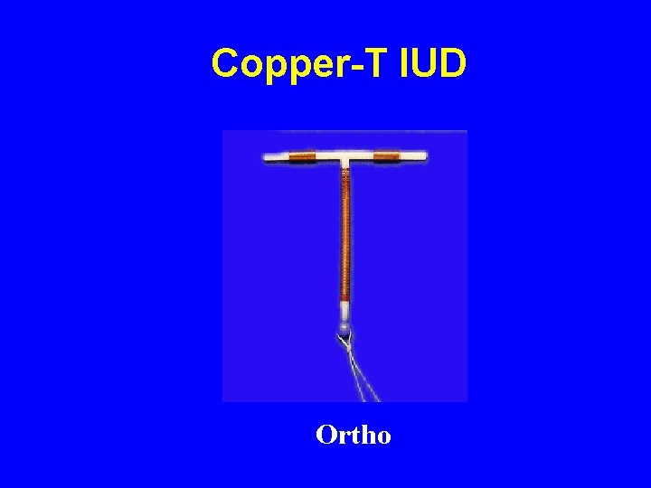 Emergency Contraception A Well Kept Secret Tony Ogburn