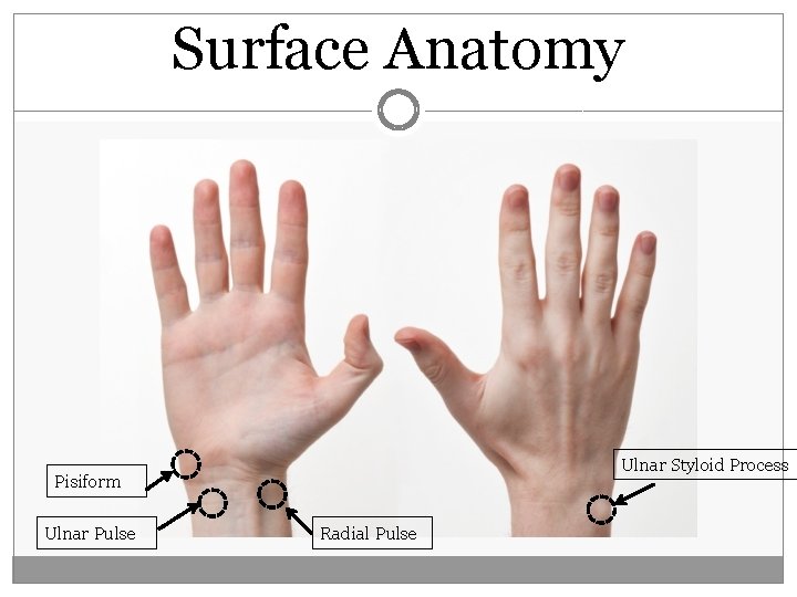 Surface Anatomy Ulnar Styloid Process Pisiform Ulnar Pulse Radial Pulse  Surface Anatomy Ulnar Styloid Process Pisiform Ulnar Pulse Radial Pulse