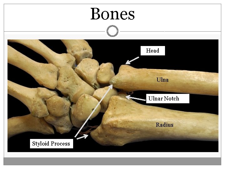 Bones Head Ulnar Notch Radius Styloid Process  Bones Head Ulnar Notch Radius Styloid Process