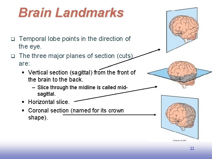 Brain Landmarks q q Temporal lobe points in the direction of the eye. The