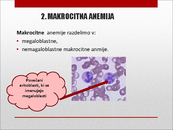 2. MAKROCITNA ANEMIJA Makrocitne anemije razdelimo v: • megaloblastne, • nemagaloblastne makrocitne anmije. Povečani