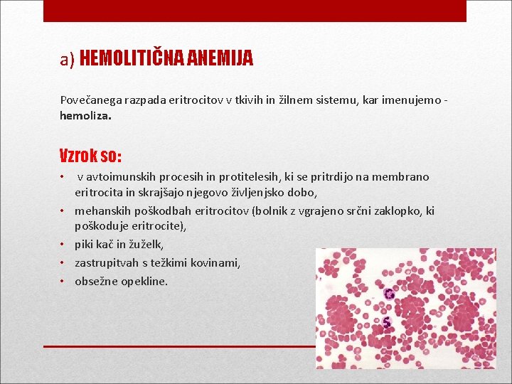 a) HEMOLITIČNA ANEMIJA Povečanega razpada eritrocitov v tkivih in žilnem sistemu, kar imenujemo hemoliza.
