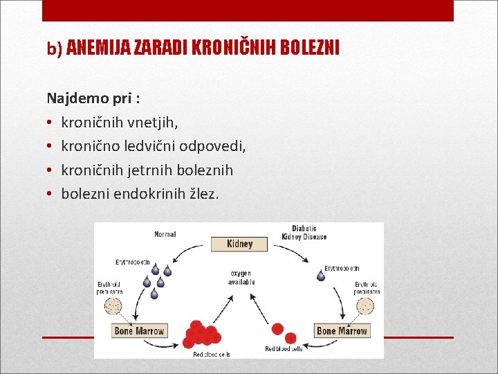 b) ANEMIJA ZARADI KRONIČNIH BOLEZNI Najdemo pri : • kroničnih vnetjih, • kronično ledvični