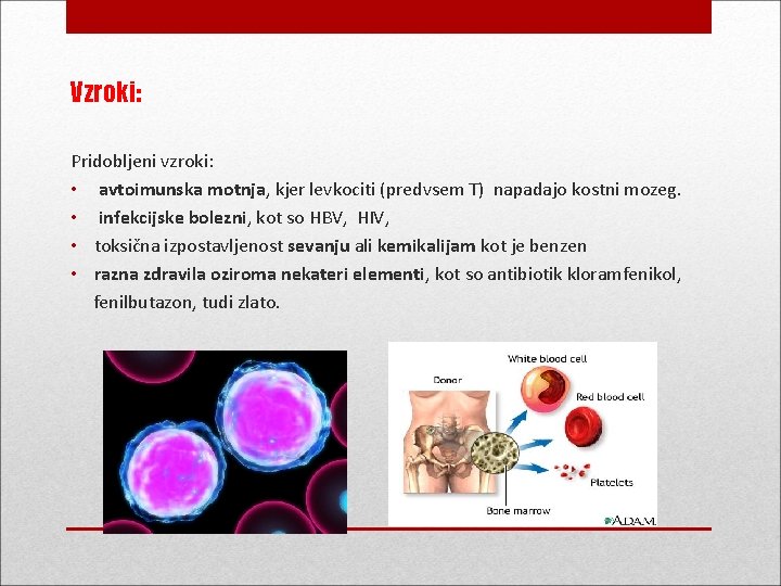 Vzroki: Pridobljeni vzroki: • avtoimunska motnja, kjer levkociti (predvsem T) napadajo kostni mozeg. •