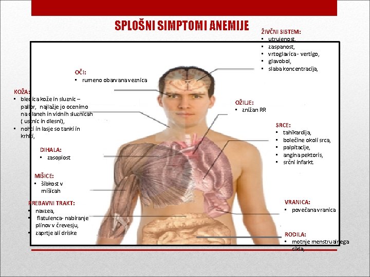 SPLOŠNI SIMPTOMI ANEMIJE OČI: • rumeno obarvana veznica KOŽA: • bledica kože in sluznic