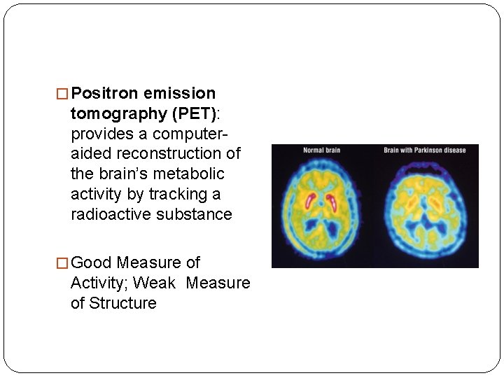 � Positron emission tomography (PET): provides a computeraided reconstruction of the brain’s metabolic activity