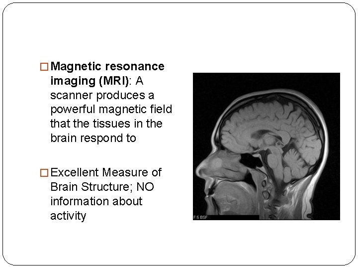 � Magnetic resonance imaging (MRI): A scanner produces a powerful magnetic field that the