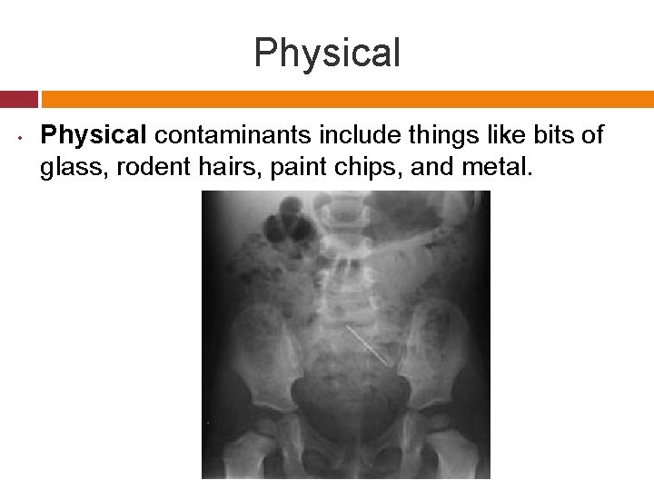 Physical • Physical contaminants include things like bits of glass, rodent hairs, paint chips,