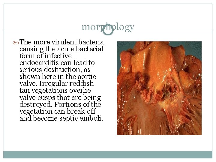 morphology The more virulent bacteria causing the acute bacterial form of infective endocarditis can