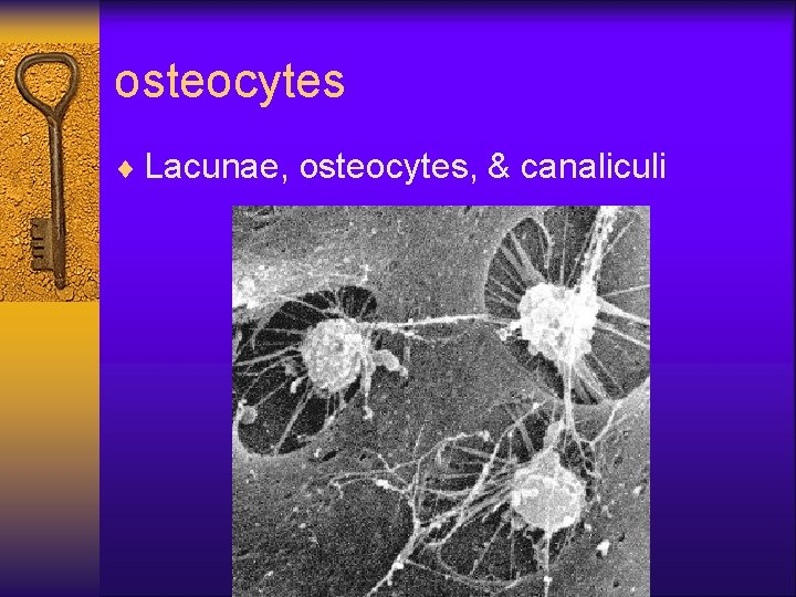 osteocytes ¨ Lacunae, osteocytes, & canaliculi 