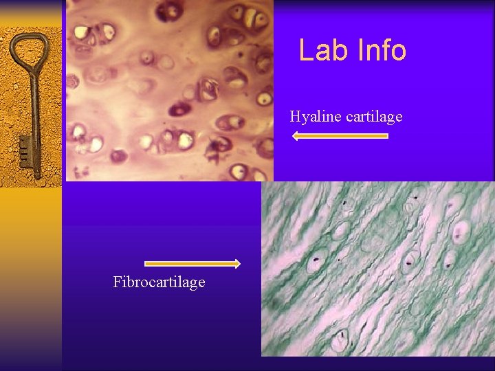 Lab Info Hyaline cartilage Fibrocartilage 