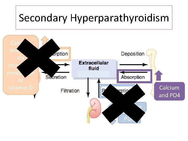 Secondary Hyperparathyroidism Calcium and PO 4 via increased production of vitamin D Calcium and