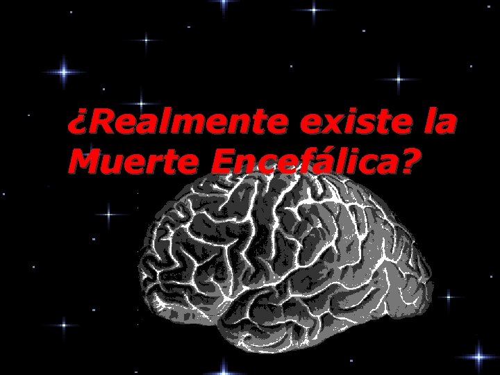 ¿Realmente existe la Muerte Encefálica? 