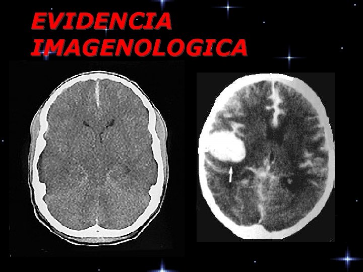 EVIDENCIA IMAGENOLOGICA 