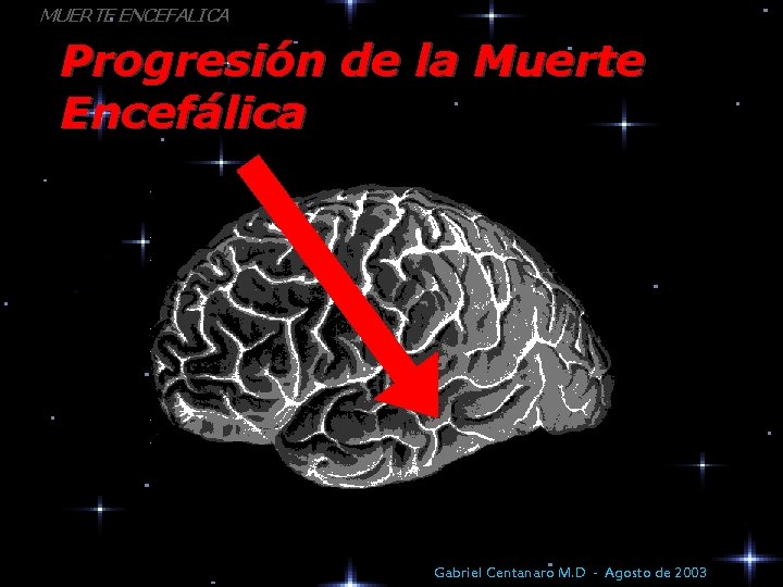 MUERTE ENCEFALICA Progresión de la Muerte Encefálica Gabriel Centanaro M. D - Agosto de