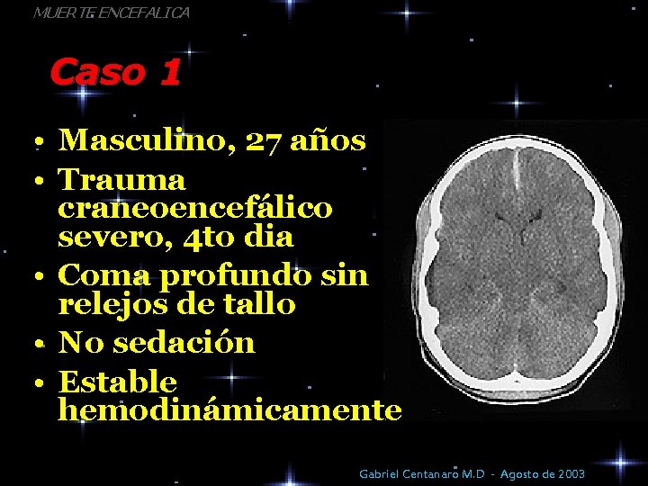 MUERTE ENCEFALICA Caso 1 • Masculino, 27 años • Trauma craneoencefálico severo, 4 to
