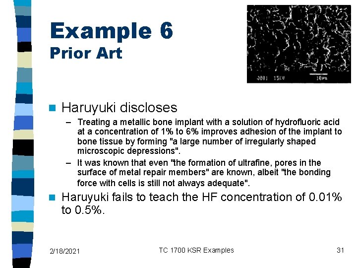 Example 6 Prior Art n Haruyuki discloses – Treating a metallic bone implant with