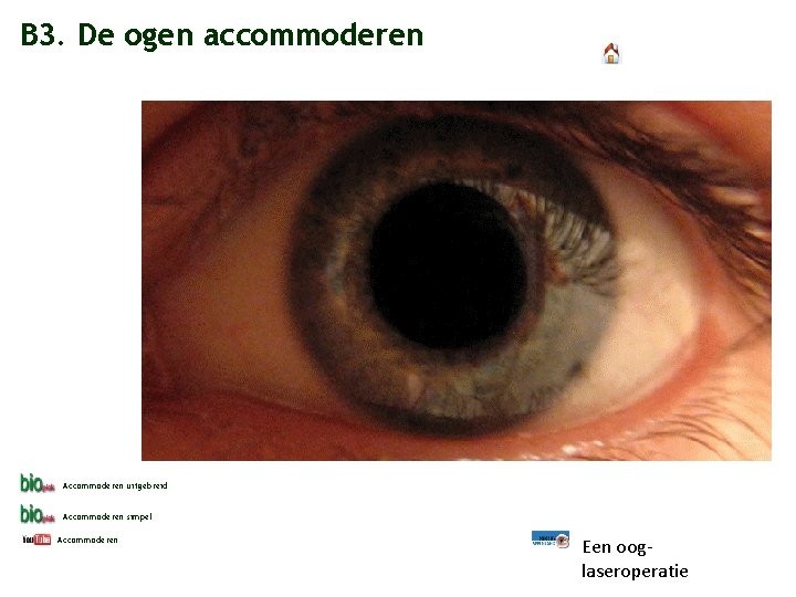 B 3. De ogen accommoderen Accommoderen uitgebreid Accommoderen simpel Accommoderen Een ooglaseroperatie 