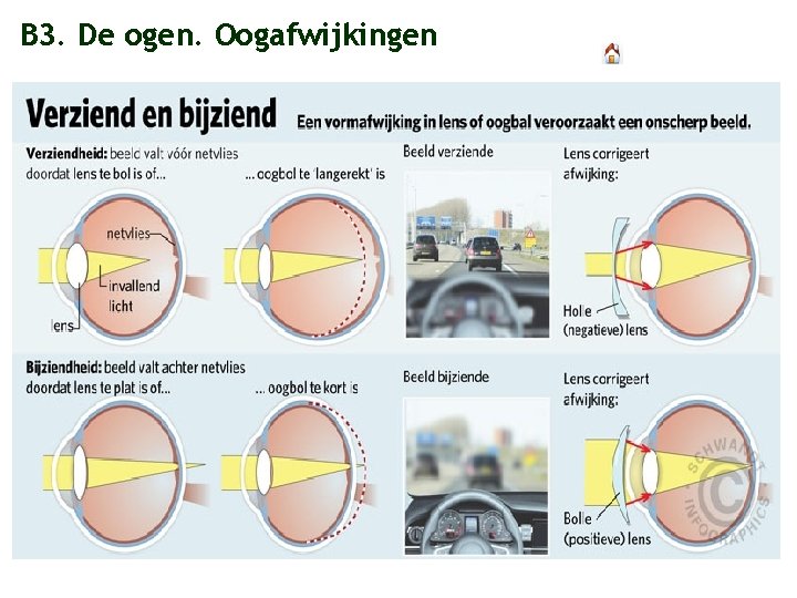 B 3. De ogen. Oogafwijkingen 