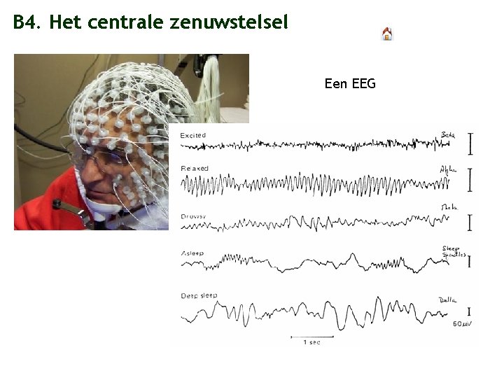 B 4. Het centrale zenuwstelsel Een EEG 