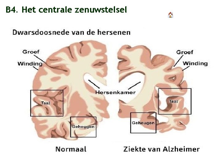 B 4. Het centrale zenuwstelsel 